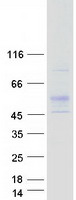 RGMA Protein - Purified recombinant protein RGMA was analyzed by SDS-PAGE gel and Coomassie Blue Staining
