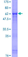 RGN / Regucalcin Protein - 12.5% SDS-PAGE of human RGN stained with Coomassie Blue