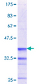 RGN / Regucalcin Protein - 12.5% SDS-PAGE Stained with Coomassie Blue.