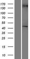 RGP1 Protein - Western validation with an anti-DDK antibody * L: Control HEK293 lysate R: Over-expression lysate