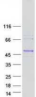 RGP1 Protein - Purified recombinant protein RGP1 was analyzed by SDS-PAGE gel and Coomassie Blue Staining