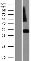 RGR Protein - Western validation with an anti-DDK antibody * L: Control HEK293 lysate R: Over-expression lysate
