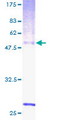 RGR Protein - 12.5% SDS-PAGE of human RGR stained with Coomassie Blue