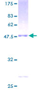 RGS1 Protein - 12.5% SDS-PAGE of human RGS1 stained with Coomassie Blue