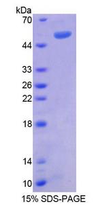 RGS1 Protein - Recombinant  Regulator Of G Protein Signaling 1 By SDS-PAGE