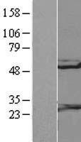 RGS10 Protein - Western validation with an anti-DDK antibody * L: Control HEK293 lysate R: Over-expression lysate
