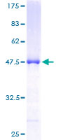 RGS10 Protein - 12.5% SDS-PAGE of human RGS10 stained with Coomassie Blue