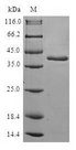 RGS10 Protein - (Tris-Glycine gel) Discontinuous SDS-PAGE (reduced) with 5% enrichment gel and 15% separation gel.
