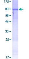 RGS11 Protein - 12.5% SDS-PAGE of human RGS11 stained with Coomassie Blue