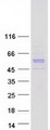 RGS11 Protein - Purified recombinant protein RGS11 was analyzed by SDS-PAGE gel and Coomassie Blue Staining