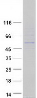 RGS11 Protein - Purified recombinant protein RGS11 was analyzed by SDS-PAGE gel and Coomassie Blue Staining