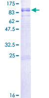 RGS12 Protein - 12.5% SDS-PAGE of human RGS12 stained with Coomassie Blue