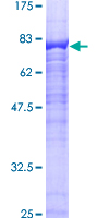 RGS14 Protein - 12.5% SDS-PAGE of human RGS14 stained with Coomassie Blue