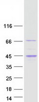 RGS14 Protein - Purified recombinant protein RGS14 was analyzed by SDS-PAGE gel and Coomassie Blue Staining
