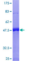 RGS16 Protein - 12.5% SDS-PAGE of human RGS16 stained with Coomassie Blue
