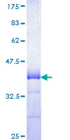 RGS16 Protein - 12.5% SDS-PAGE Stained with Coomassie Blue.