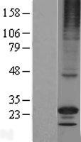 RGS17 / RGSZ2 Protein - Western validation with an anti-DDK antibody * L: Control HEK293 lysate R: Over-expression lysate