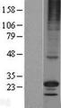 RGS17 / RGSZ2 Protein - Western validation with an anti-DDK antibody * L: Control HEK293 lysate R: Over-expression lysate