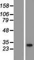RGS18 Protein - Western validation with an anti-DDK antibody * L: Control HEK293 lysate R: Over-expression lysate