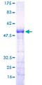 RGS18 Protein - 12.5% SDS-PAGE of human RGS18 stained with Coomassie Blue