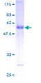 RGS19 Protein - 12.5% SDS-PAGE of human RGS19 stained with Coomassie Blue