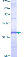 RGS19 Protein - 12.5% SDS-PAGE Stained with Coomassie Blue.