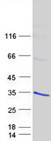 RGS19 Protein - Purified recombinant protein RGS19 was analyzed by SDS-PAGE gel and Coomassie Blue Staining