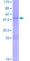 RGS2 Protein - 12.5% SDS-PAGE of human RGS2 stained with Coomassie Blue