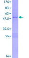 RGS2 Protein - 12.5% SDS-PAGE of human RGS2 stained with Coomassie Blue