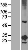RGS20 / RGSZ1 Protein - Western validation with an anti-DDK antibody * L: Control HEK293 lysate R: Over-expression lysate