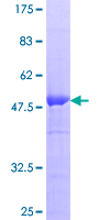 RGS20 / RGSZ1 Protein - 12.5% SDS-PAGE of human RGS20 stained with Coomassie Blue