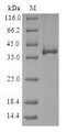 RGS20 / RGSZ1 Protein - (Tris-Glycine gel) Discontinuous SDS-PAGE (reduced) with 5% enrichment gel and 15% separation gel.