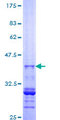 RGS20 / RGSZ1 Protein - 12.5% SDS-PAGE Stained with Coomassie Blue.