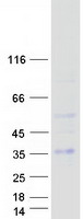 RGS20 / RGSZ1 Protein - Purified recombinant protein RGS20 was analyzed by SDS-PAGE gel and Coomassie Blue Staining