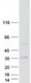 RGS20 / RGSZ1 Protein - Purified recombinant protein RGS20 was analyzed by SDS-PAGE gel and Coomassie Blue Staining