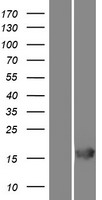 RGS21 Protein - Western validation with an anti-DDK antibody * L: Control HEK293 lysate R: Over-expression lysate