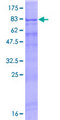 RGS22 Protein - 12.5% SDS-PAGE of human RGS22 stained with Coomassie Blue