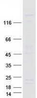 RGS3 Protein - Purified recombinant protein RGS3 was analyzed by SDS-PAGE gel and Coomassie Blue Staining