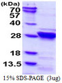 RGS4 Protein