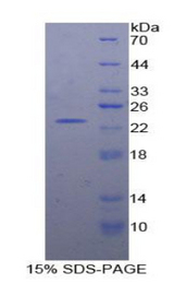 RGS4 Protein - Recombinant Regulator Of G Protein Signaling 4 By SDS-PAGE