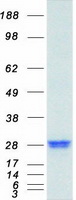 RGS4 Protein - Purified recombinant protein RGS4 was analyzed by SDS-PAGE gel and Coomassie Blue Staining