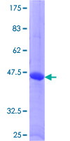 RGS5 Protein - 12.5% SDS-PAGE of human RGS5 stained with Coomassie Blue
