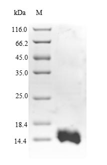 RGS5 Protein - (Tris-Glycine gel) Discontinuous SDS-PAGE (reduced) with 5% enrichment gel and 15% separation gel.