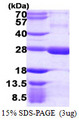 RGS5 Protein