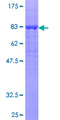 RGS6 Protein - 12.5% SDS-PAGE of human RGS6 stained with Coomassie Blue