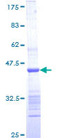 RGS6 Protein - 12.5% SDS-PAGE Stained with Coomassie Blue.
