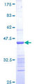 RGS6 Protein - 12.5% SDS-PAGE Stained with Coomassie Blue.