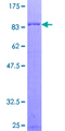 RGS7 Protein - 12.5% SDS-PAGE of human RGS7 stained with Coomassie Blue