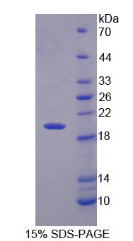 RGS7 Protein - Recombinant Regulator Of G Protein Signaling 7 (RGS7) by SDS-PAGE