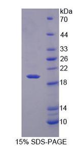 RGS7 Protein - Recombinant Regulator Of G Protein Signaling 7 (RGS7) by SDS-PAGE